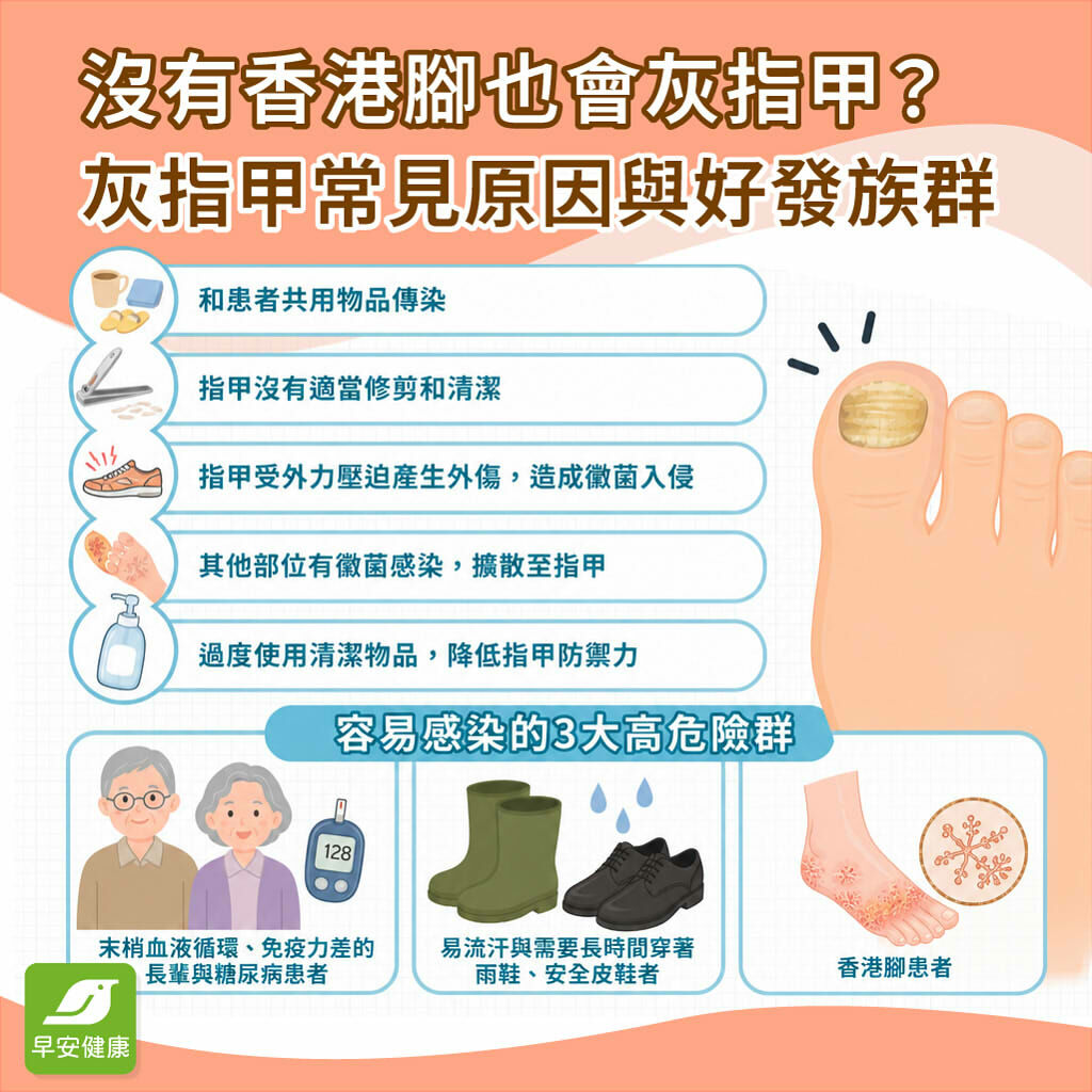 灰指甲症狀有哪些？治療灰指甲最好辦法與偏方迷思全解析