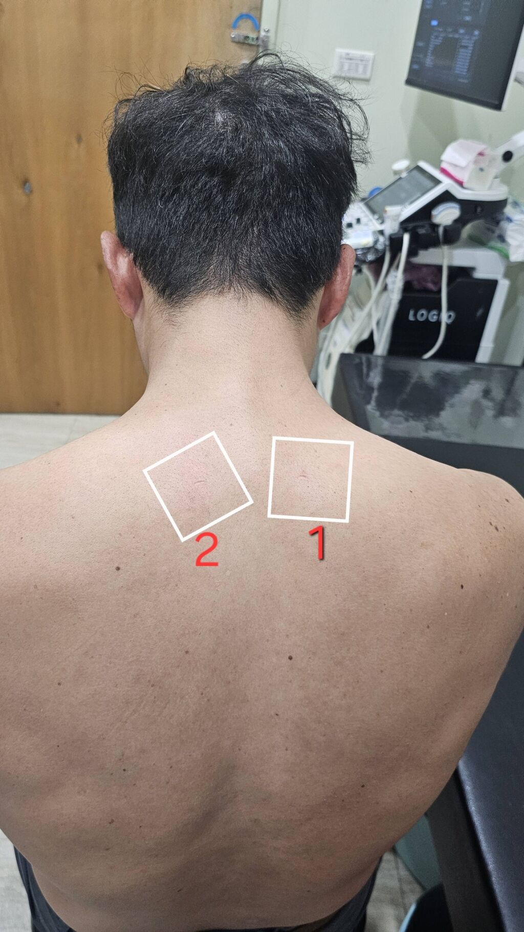 侯鐘堡醫師_上斜方肌