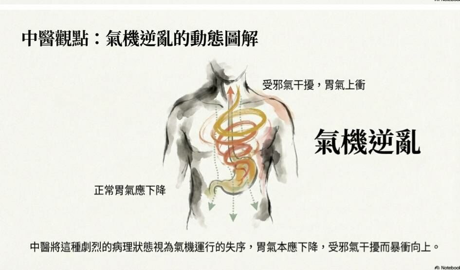 余雅雯中醫師＿為什麼得諾羅會噴射性嘔吐？中醫觀點