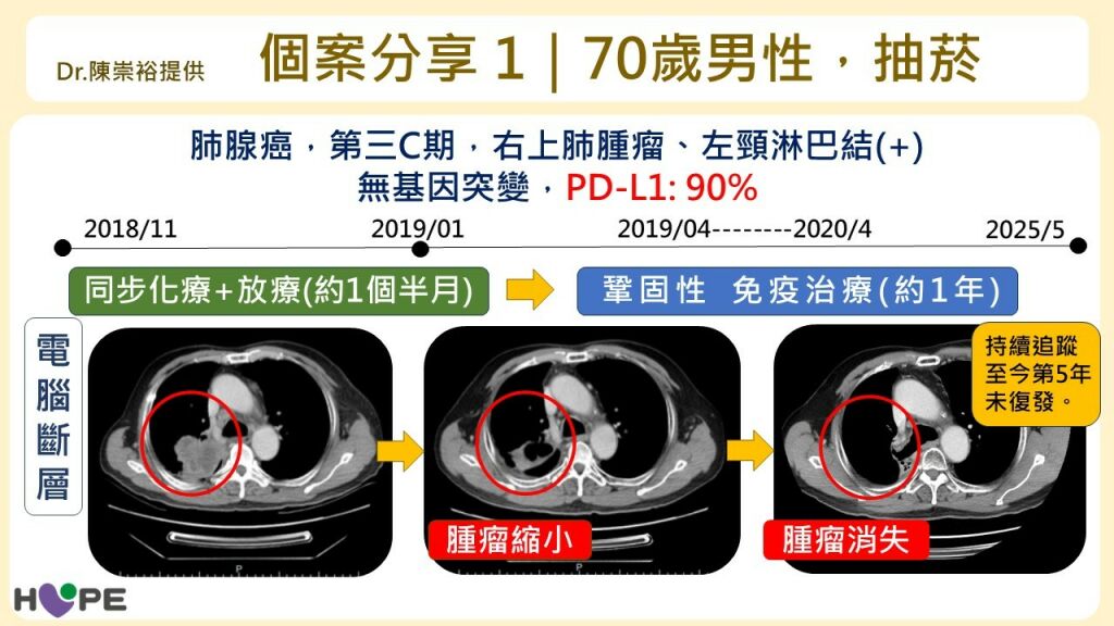 癌症希望基金會＿肺癌個案分享