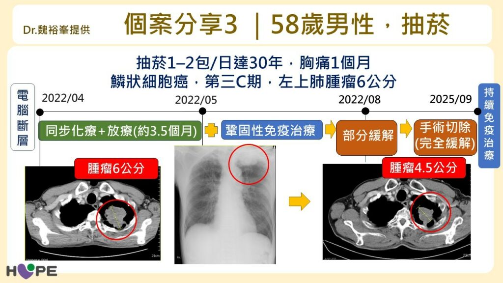 癌症希望基金會＿個案分享