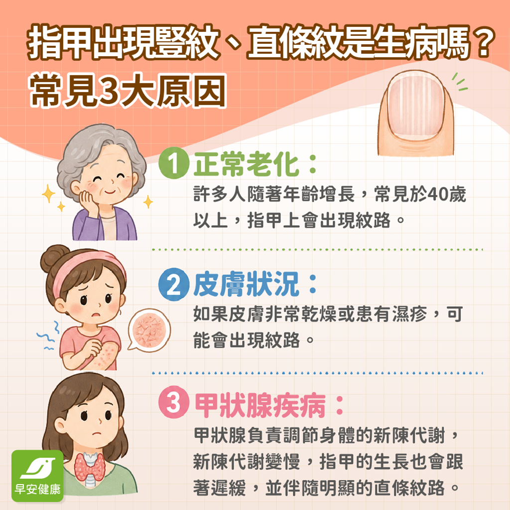 指甲出現豎紋-指甲直條紋是生病嗎-指甲豎紋原因