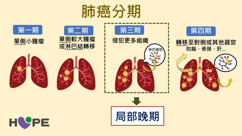 癌症希望基金會＿肺癌分期