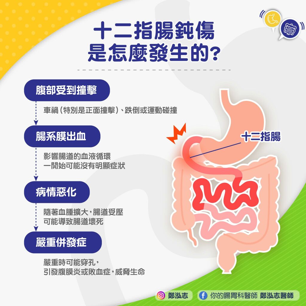 鄭泓志醫師_十二指腸鈍傷是怎麼發生的？