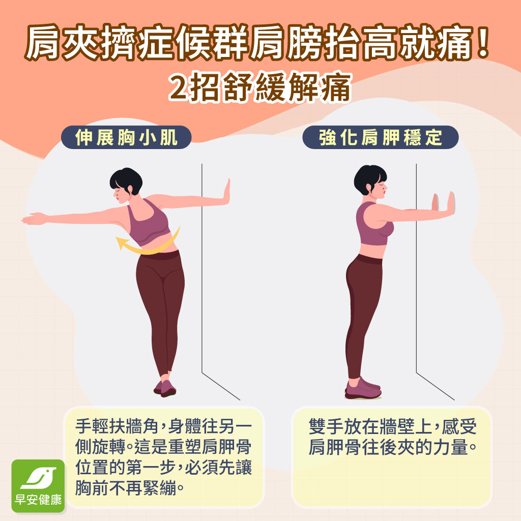 肩夾擠症候群-復健運動