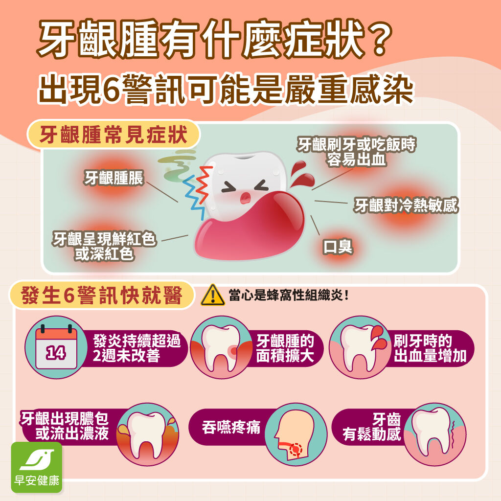 牙齦腫-牙齦腫症狀-牙齦腫痛-牙齦出血