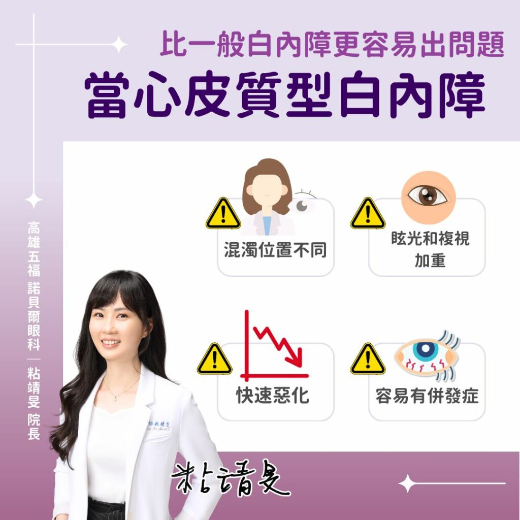 粘靖旻眼科女醫師_皮質型白內障