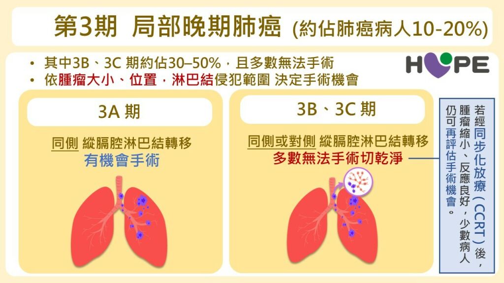 癌症希望基金會＿局部晚期肺癌