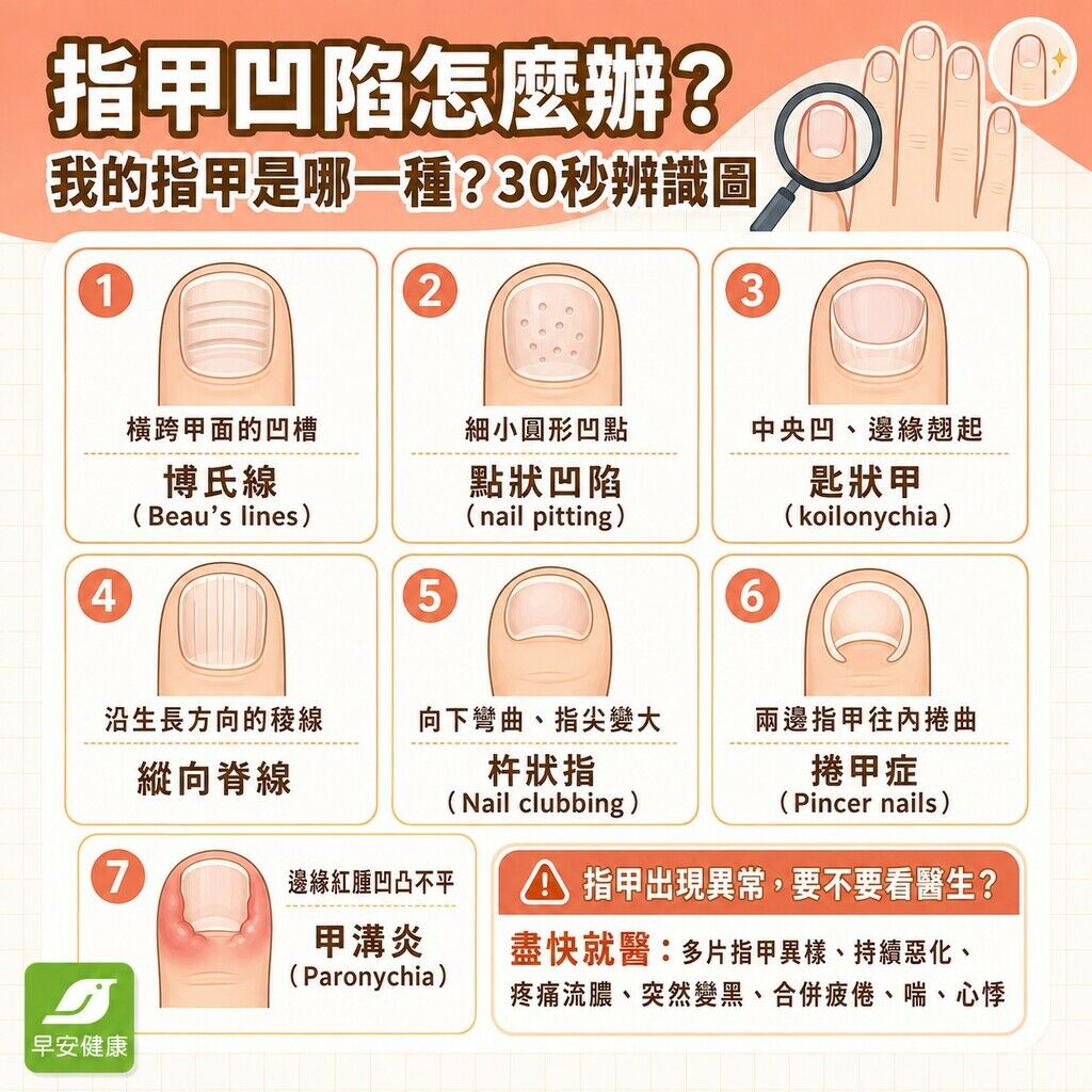 早安_指甲凹陷怎麼辦?